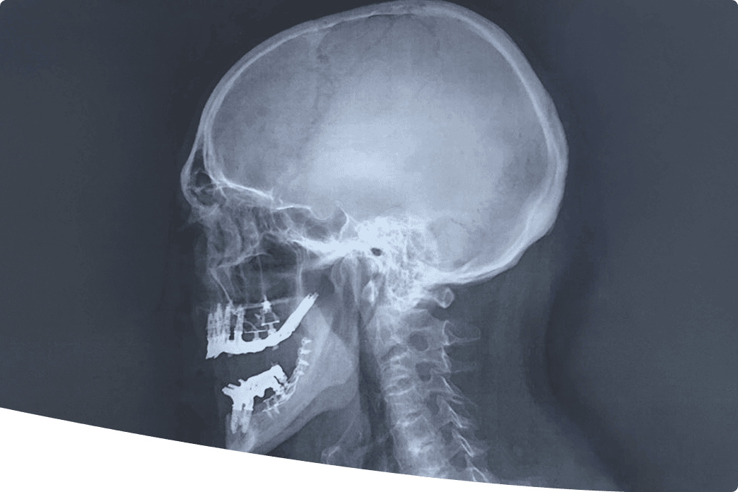 Implantologie-basal